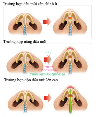 Cac me cho hoi thu nho dau mui co dau khong