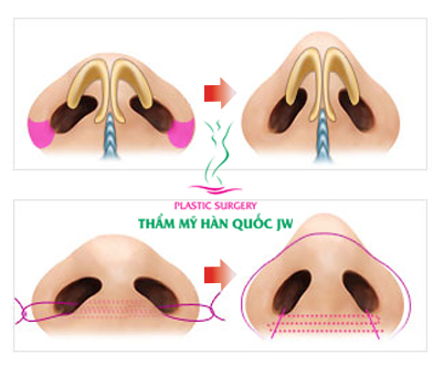 Thu gon canh mui cho nam gioi the nao